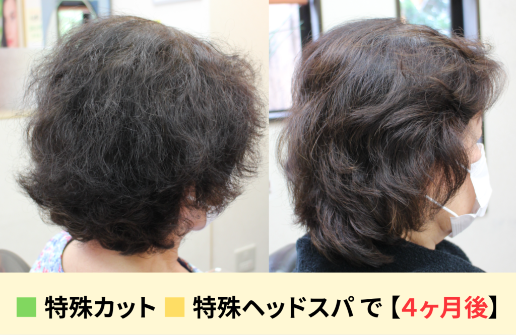 ハリコシや艶の喪失したダメージ毛を「特殊カット&特殊ヘッドスパ」を使い、4ヶ月間で改善したビフォーアフターの写真