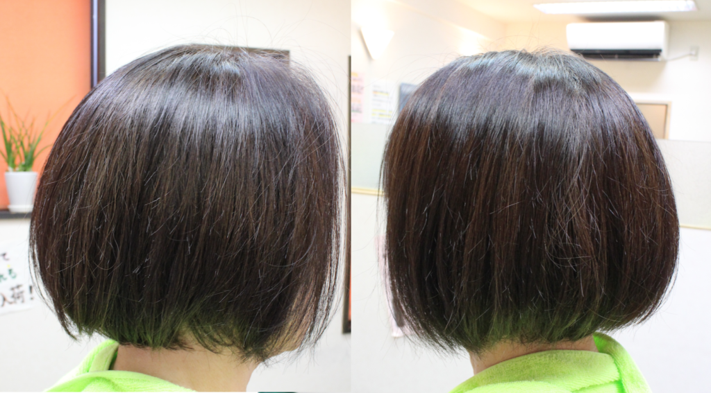 後頭部の髪の生え方が、立って生えてるので膨れてしまう髪を「髪質改善くせ毛カット」で膨れる状態を改善する前の写真