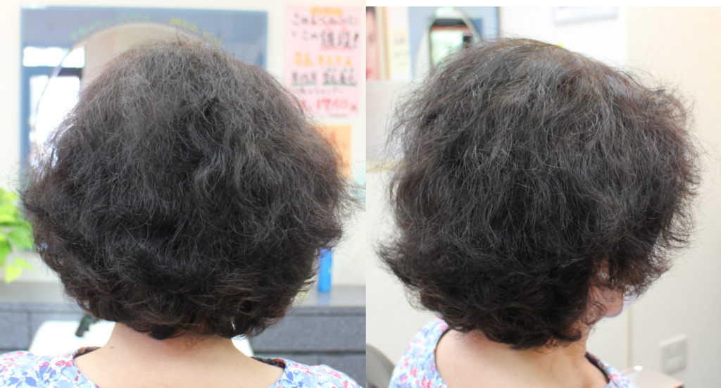 髪のハリコシや艶がない髪を、特殊カットや特殊ヘッドスパで綺麗に改善する前の写真